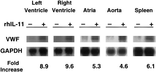 Figure 3. In normal dogs, rhIL-11 up-regulates VWF mRNA levels. For 7 consecutive days, rhIL-11 was given to a normal dog. A second normal dog was used as a control. Tissues were harvested, and total RNA was analyzed by Northern blot analysis for the presence of VWF mRNA with the use of canine VWF cDNA as probes. Changes in VWF mRNA were normalized to GAPDH mRNA levels by densitometric quantitation of the autoradiographs. Representative gels are shown for each tissue. Only faint VWF bands appear at baseline, and these increase markedly with rhIL-11 treatment. Results are presented for 5 tissues (left ventricle, right ventricle, atria, aorta, and spleen) as fold increase between treated and untreated animal for the gels shown. No change in VWF mRNA was seen in the homozygous VWD dog treated with rhIL-11 (data not shown).
