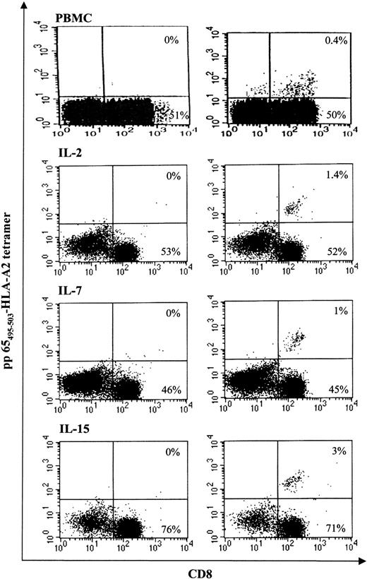 Figure 6. CTLs specific for pp65 from CMV are preserved in LV-transduced cells. T cells specific for the immunodominant HLA-A0201–restricted pp65495-503 peptide derived from the matrix protein pp65 of CMV were detected by staining with CD8-QR, pp65 tetramer-PE, and LNGFr-FITC on IL-2–, IL-7–, IL-15–stimulated and transduced cells or CD3-FITC on PBMCs followed by flow cytometry analysis. The right panels show the percentage of CD8+/pp65-tetramer+ T cells analyzed on CD3+ cells on PBMCs and on LNGFr+ T cells and IL-2, IL-7, and IL-15 cells. Appropriate isotypic controls are shown in the left panels.