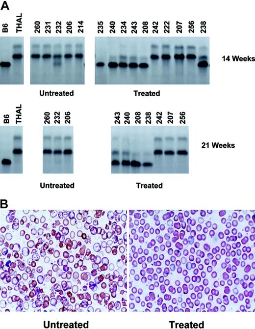 Figure 3. In vivo selection of transplanted MGMT-transduced normal BM cells results in sustained hematologic improvement in nonmyeloablated β-thalassemic mice. (A) Cellulose acetate gel electrophoresis of red cell lysates from donor C57BL/6 (B6), recipient β-thalassemic (THAL), and untreated control and drug-treated β-thalassemic recipient animals 14 weeks (top row) and 21 weeks (bottom row) after transplantation with 7 ×106 MGMT-transduced, nucleated BM cells. The MGMT-transduced, donor B6 graft has the “single” hemoglobin pattern, while the recipient THAL has the “diffuse” pattern. Mouse identification numbers are shown at the top of each lane. (B) Wright-Giemsa–stained blood smears are shown for a representative control, untreated animal (left) and for a drug-treated animal that demonstrated in vivo selection of transduced cells (right). Original magnification, × 250.