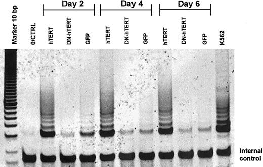 Figure 1. Inhibition of telomerase activity by ectopic DN-hTERT expression. Telomerase activity in a culture of polyclonal T cells isolated from donor PBMCs transduced with DN-hTERT (Asp868Ala, Asp869Ala)–GFP, hTERT-GFP, or control GFP after 2, 4, and 6 days of stimulation. Telomerase activity was detected in control GFP-transduced cells 2 to 4 days after stimulation and was absent in the DN-hTERT–transduced cells. In hTERT-transduced cells telomerase activity was present at all time points analyzed. Each lane shows the telomerase activity present in 2000 cells analyzed by the TRAP assay. K562 cells were tested as a positive control for telomerase activity. Results are representative of 3 experiments.