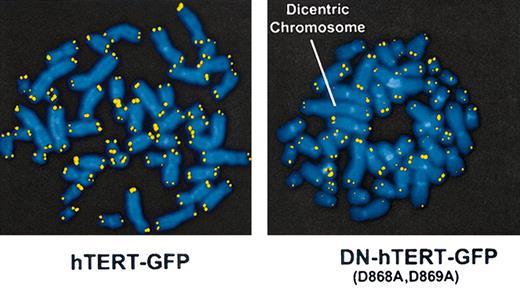 Figure 4. DN-hTERT–transduced cells show chromosomal abnormalities. Q-FISH analysis of metaphase chromosomes isolated from human CD4+ T cells that have undergone approximately 45 PD and were transduced with DN-hTERT (Asp868Ala, Asp869Ala)–GFP or hTERT-GFP at approximately 24 PD. Telomeres are visualized in yellow by hybridization with the Cy-3–labeled (CCCTAA)3 PNA probe. The arrow indicates a dicentric chromosome found in DN-hTERT (Asp868Ala, Asp869Ala)–GFP–transduced cells. Results are representative of 16 metaphases of DN-hTERT–transduced cells and 20 metaphases of hTERT-transduced cells analyzed.