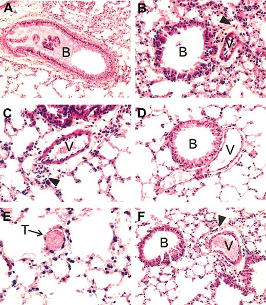 Figure 1. Lung histopathology of SAD mice exposed to hypoxia/reoxygenation and effect of inhaled NO. In the left panels are shown representative examples of SAD mouse lungs exposed to hypoxia/reoxygenation for 46 hours. (A) More than 50% of the bronchus lumen (B) is filled with mucus; (C), a constricted vessel (V) is evident for the large surrounding clear area containing many inflammatory cells; (E), a small vessel filled with a thrombus (T) is shown. (B) Representative section of a SAD mouse lung exposed to hypoxia/reoxygenation and inhaled NO. Here the bronchus lumen (B) is devoid of mucus, the constriction of the vessel (V) is much less intense than that seen in panel C, as evident by the clear area around the vessel whose thickness is not superior to that of the vessel wall, associated with a mild inflammatory infiltrate. Panel D exemplifies the lung histology of SAD mice under normoxia. The lumen of the bronchus (B) is devoid of mucus; the neighboring vessel (V) is not constricted and contains few red blood cells. There is no inflammatory infiltrate. (F) Example of lung histopathology of wild-type mice exposed to 46 hours hypoxia/reoxygenation. The lumen of the bronchus (B) is devoid of mucus; the neighboring vessel (V), filled with erythrocytes, is constricted, with a mild inflammatory infiltrate (arrowhead) in the clear area surrounding the vessel. All tissue sections are stained with hematoxylin and eosin, and the original magnification is × 250 (with the exception of panel A, × 200).