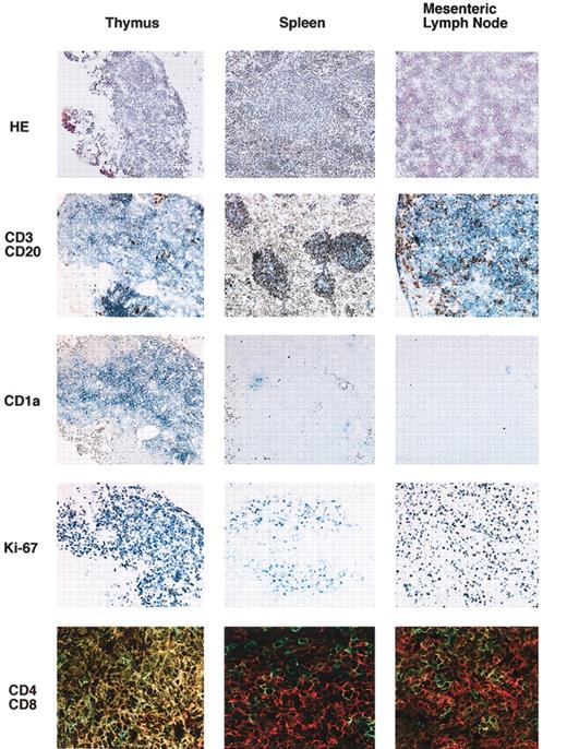 Figure 7. Immunohistochemical staining of the thymus, spleen, and mesenteric lymph nodes. Six months after transplantation, various organs were taken, and frozen sections were prepared. Expressions of human CD3 (Vector Blue)/human CD20 (DAB), human CD1a (Vector Blue), human Ki-67 (Vector Blue), and human CD4 (Alexa 488)/human CD8 (Cy3) were evaluated. Original magnification is × 400 for CD4/CD8 images, × 100 for all others.