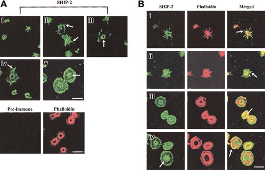 Figure 2. SHIP-2 localizes to actin-rich regions in spreading platelets. (A) Platelets spread on a VWF matrix were fixed, permeabilized, stained with SHIP-2 antibodies, or costained with affinity-purified preimmune sera and phalloidin and visualized by confocal microscopy. Arrows indicate SHIP-2 staining at filopodia (ii), the central actin ring (iii), lamellipodia (iv) and diffuse central staining detected in some spread platelets (v). Bar, 10 μm. (B) Platelets spread on a VWF matrix were fixed, permeabilized, costained with affinity-purified SHIP-2 antibodies and phalloidin, and visualized by confocal microscopy. Arrows indicate colocalization of SHIP-2 and phalloidin at filopodia (i-ii), at the inner actin ring (iii) and at lamellipodia (iv) (merged images). The arrow showing SHIP-2 staining in subpanel iv indicates diffuse central staining detected in some spread platelets. Bar, 10 μm.