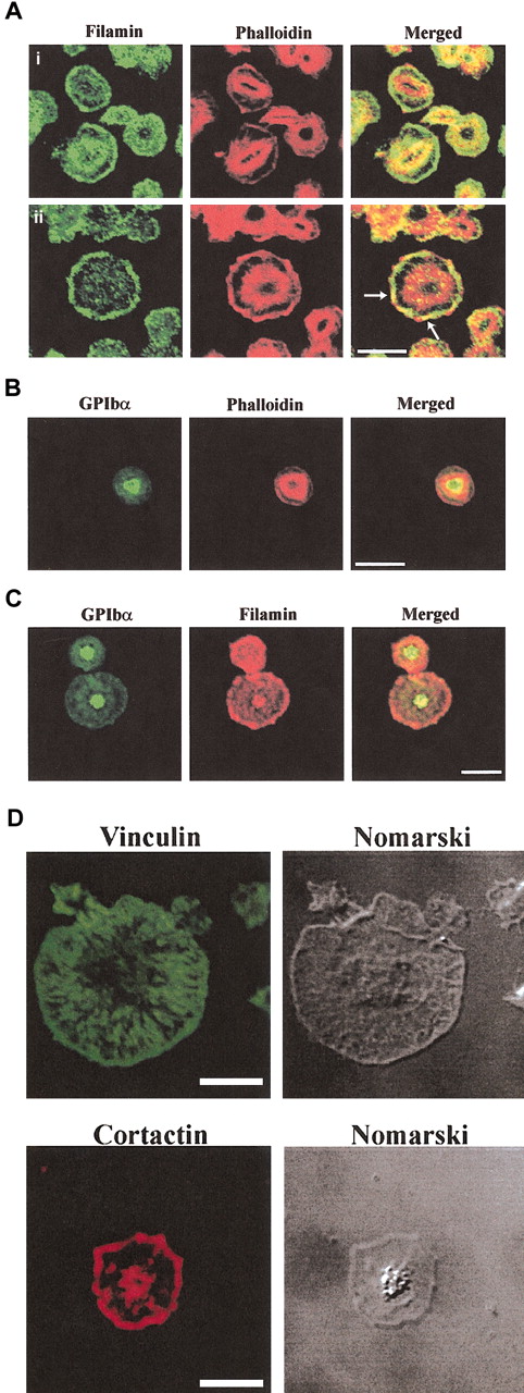 Figure 5. Localization of filamin, GPIb and actin in spreading platelets. Platelets spread on a VWF matrix were fixed, permeabilized, and costained with filamin antibodies and phalloidin (Ai-ii), GPIbα antibodies and phalloidin (B), GPIbα and filamin antibodies (C), vinculin antibodies (D), and cortactin antibodies (D). Arrows in merged images in (5Aii) indicate colocalization of filamin and submembraneous actin at lamellipodia. Cells were visualized by confocal microscopy. Bars, 10 μm.