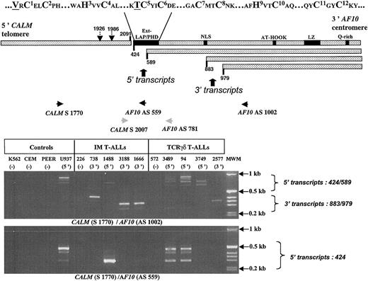 Figure 2. CALM-AF10. (Top) CALM-AF10 fusion gene. Wild-type AF10 functional domains are indicated and the cysteines of the extended LAP/PHD motif are detailed. CALM and AF10 exon nomenclatures are reference sequences NM007166 and NM004641, respectively. Nucleotide nomenclature is identical to that used previously.10 Identified FT points within CALM and AF10 are shown as vertical arrows with solid lines, alternative splice sites as vertical arrows with dotted lines. Position of RT-PCR (black) and sequencing (gray) primers are indicated. (Bottom) RT-PCR products using AF10 AS1002 (upper) or AF10 AS559 (lower) primers in CALM-AF10+ patients with IM or TCRγδ T-ALLs. Unique patient numbers (UPNs) are indicated above each lane. MWM indicates molecular weight markers.