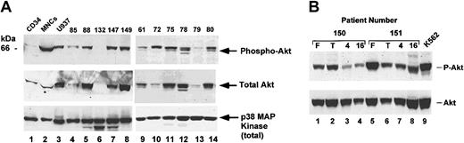 Figure 1. Akt phosphorylation in AML cells. (A) Patient samples were thawed, washed, harvested by centrifugation, and lysed in 1% Triton-X 100 lysis buffer; 100 μg cell lysates were loaded on SDS-PAGE gel and analyzed by Western blotting. Blots were probed with phospho-Akt antibody (top panel) and then stripped and reprobed with total Akt antibody (middle panel). As a loading control, lower portion of blot was separately probed with antibody against p38 MAP kinase (bottom panel). As a positive control for Akt phosphorylation, the human leukemia cell line U937 was analyzed. CD34+ cells and CD34-depleted MNCs were purified as described and lysed in parallel. (B) Fresh patient samples were purified by Ficoll gradient and MNCs obtained prior to freezing (lanes 1 and 5) or frozen and then thawed. Samples after thawing were collected immediately (lanes 2 and 6) or incubated in serum-free medium with no cytokines for the indicated times (lanes 3-4, 7-8). K562 cells were used as positive control (lane 9).