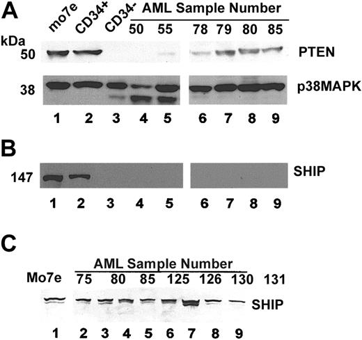 Figure 6. AML cells express the SHIP and PTEN phosphatases. MO7e cells in log phase growth (lane 1), purified CD34+ cells (lane 2), or CD34-depleted MNCs (lane 3), and patient samples were lysed in 1% Triton X-100 lysis buffer (A,B). Protein lysates were quantitated and 100 μg protein loaded for analysis by SDS-PAGE. (A) Blot was probed for expression of PTEN (upper panel). Blot was separated and lower portion separately probed for expression of p38 MAP kinase as a loading control (lower panel). (B) The upper portion of the same blot as in A was probed for SHIP. (C) In a separate experiment, samples were thawed, pelleted by centrifugation, and immediately lysed by boiling in 10% SDS with 2-mercaptopurine present. Samples were equalized to 1 million cells per lane. Proteins were again analyzed by SDS-PAGE using the same antibody to probe for SHIP expression. In contrast to panel B, SHIP expression was present in all samples analyzed.
