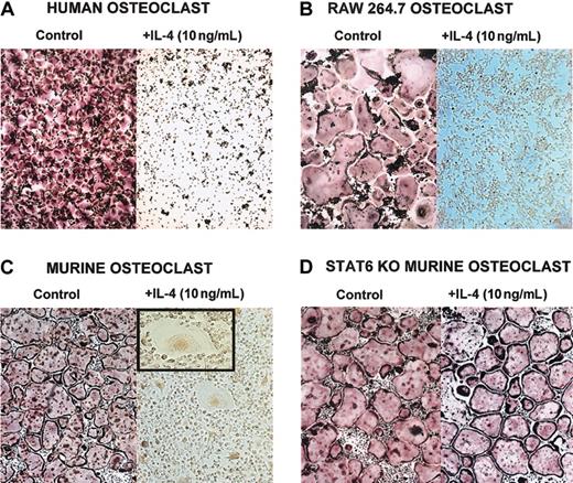 Figure 1. IL-4 inhibits osteoclast differentiation by acting directly on progenitor cells. Cells were stained for TRAP, and osteoclasts were identified as multinucleated TRAP-positive (red-stained) cells. (A) CD14+ human monocytes were cultured with rhM-CSF (20 ng/mL) and RANKL (150 ng/mL) ± rhIL-4 (10 ng/mL) for 5 days. (B) RAW264.7 cells were cultured with rmM-CSF (20 ng/mL) and RANKL (150 ng/mL) ± rmIL-4 (10 ng/mL) for 5 days. At the end of all culture periods, the plates were stained for TRAP. (C) BMMs were isolated from wild-type or (D) STAT6-/- mice and were cultured for 3 days in the presence of rmM-CSF (20 ng/mL) to obtain a homogeneous population of M-CSF–dependent adherent macrophages. They were then differentiated to osteoclasts by culturing for 7 days in the presence of rmM-CSF (20 ng/mL), RANKL (150 ng/mL), and rmIL-4 (10 ng/mL). Panel C inset shows a magnified image of an MNG (original magnification, × 20). Original magnification, × 10 for panels A-D.
