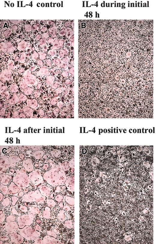 Figure 5. Irreversible commitment of BMMs to osteoclasts during the first 48 hours. BMMs from wild-type mice were cultured in the presence of rmM-CSF (20 ng/mL) and RANKL (150 ng/mL) in the presence or absence of rmIL-4 (10 ng/mL) for various time periods, as indicated. (A) BMMs without rmIL-4. (B) rmIL-4 was present only during the first 48 hours. Then rmIL-4 was removed by washing the wells 3 times with α-10 media, and the cultures continued in this media and were complemented with rmM-CSF (20 ng/mL) and RANKL (150 ng/mL) for 5 days. (C) After 2 days of culture in the presence of RANKL and rmM-CSF, rmIL-4 (10 ng/mL) was added to the cultures for 5 days. (D) rmIL-4 was present throughout the culture period. At the end of the culture period, cells were fixed and stained for TRAP. TRAP stain; original magnification, × 10 for all panels.