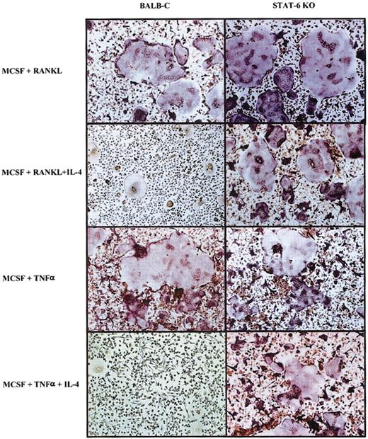 Figure 9. IL-4 inhibition of TNF-α–induced osteoclastogenesis. Bone marrow cells from wild-type and STAT6-/- animals were cultured with rmM-CSF (100 ng/mL) for 3 days. Subsequently, RANKL (150 ng/mL) ± rmIL-4 (10 ng/mL) or rmTNF (20 ng/mL) ± rmIL-4 (10 ng/mL) was added to the BMM, keeping the concentration of M-CSF (100 ng/mL) constant until the end of the experiment 3 days later. Cells were fixed and stained for TRAP activity. TRAP stain; original magnification, × 10.