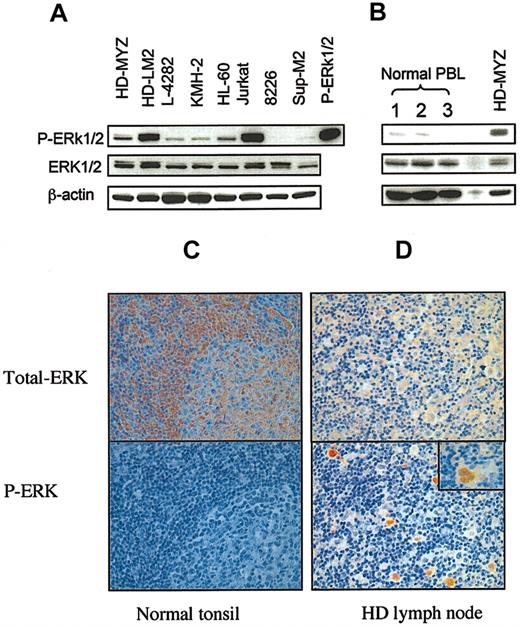 Figure 1. Expression of ERK in cultured and primary HD cells. Total cell lysates were examined for the expression of ERK and phosphorylated ERK (p-ERK) by Western blot. (A) Expression of ERK in 4 HD cell lines (HD-MYZ, HD-LM2, L-428, and KMH-2) and in 4 other CD30+ lymphoid cell lines. All HD-derived cell lines expressed p-ERK, but HD-LM2 expressed the highest level. The Jurkat cell line also expressed high levels of p-ERK. The multiple myeloma cell line 8226 and the anaplastic large-cell lymphoma cell line SUP-M2 did not express p-ERK. The p-ERK protein was used as a positive control. (B) Expression of p-ERK in peripheral blood lymphocyte (PBL) samples from 3 healthy individuals was either weak or undetectable. (C) Histochemical staining of a normal tonsil for total ERK (upper panel) and p-ERK (lower panel) (× 40). Normal tonsillar cells expressed total ERK, but they did not express p-ERK. (D) A section of lymph node involved with nodular sclerosis HD was stained for total ERK (upper panel) or p-ERK (lower panel). Both benign and malignant cells expressed total ERK. However, only the malignant Reed-Sternberg cells expressed p-ERK (lower panel, × 10). Inset in the lower panel shows a Reed-Sternberg cell with intense nuclear staining of p-ERK (× 40).