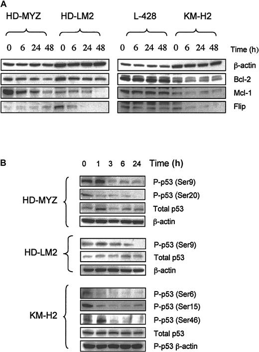 Figure 4. Effect of UO126 (25 μM) on intracellular proteins that regulate cell cycle and survival. (A) UO126 reduced intracellular levels of Bcl-2, Mcl-1, and FLIP proteins in 3 of 4 HD cell lines. (B) UO126 resulted in loss of p53 phosphorylation at several sites in 3 HD cell lines.