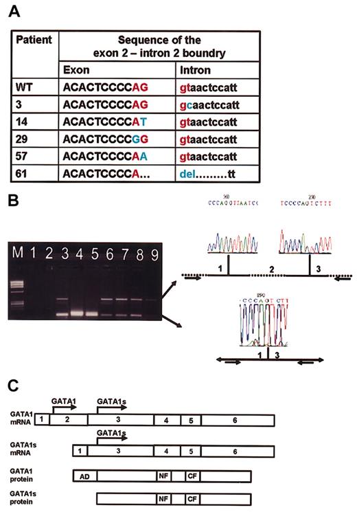 Figure 2. Alternative splicing of GATA1. (A) The sequence of the junction between exons 2 and intron 2 in 5 patients compared with wild-type sequence (first row). (B) RT-PCR analysis. M indicates marker. Lane 1: PCR-mix; lane 2: RT-mix (negative controls). Lanes 3-5: patients with splice mutations in GATA1 (patients 3, 57, and 61, respectively). Lane 6: patient 19 at diagnosis (no splice mutation); lane 7: normal bone marrow; lane 8: K562; lane 9: patient 68 (leukemia with no mutation in GATA1). The larger fragment (348 bp) corresponds to the normal splicing of exon 1 to 2 and then exon 2 to3. The smaller fragment (109 bp) corresponds to an alternative splice variant in which exon 1 is spliced to exon 3. (C) Alternative models for generation of GATA1 isoforms. The full GATA1 protein can only be translated from the full GATA1 mRNA, whereas the GATA1s protein can be translated either from the full GATA1 mRNA or from the shorter splice variant in which exon 2 is skipped.