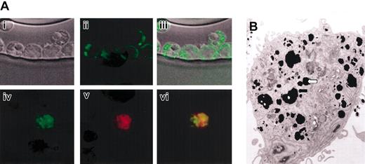 Figure 3. Confocal fluorescent and electron microscopy of CD34+ cells. Human CD34+ cells exposed to 10 μL/mL of the iron oxide fluorescent particles for 18 hours, washed, and analyzed. (A) Depicted are phase contrast images of the CD34+ cells (i) and the green fluorescence of the cells (ii). Panel Aiii shows an overlay of panels Ai and Aii. Also shown is green fluorescence from the iron oxide particles within the cell (iv) and Cell Tracker Orange fluorescence of the cytoplasm of viable cells (v). Panel Avi shows an overlay of panels Aiv and Av, demonstrating a granular distribution of the particle fluorescence throughout the cytoplasm of the cell. Original magnification for Ai-Avi, × 400. (B) Electron micrograph of single CD34+ cell showing accumulation of iron particles into membrane-bound organelles (arrows indicate examples). Original magnification, × 400.