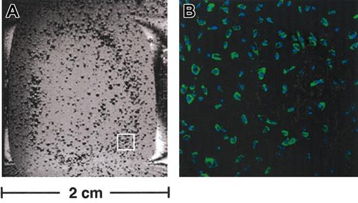 Figure 7. Magnetic resonance imaging of live particle-loaded cells. (A) One slice from a 3-dimensional MR data set showing a single chamber of a culture dish containing live, labeled MSCs in culture media. Single cells are present where there are dark spots in the dish, owing to the susceptibility effect of the endocytosed particles. (B) Representative confocal image of the area within the white box in panel A from the same chamber slide showing highly efficient labeling (green fluorescence) of nearly 100% of the plated cells (nuclei counterstained with DAPI). Original magnification for panel B, × 100.