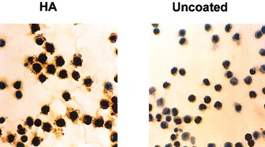 Figure 1. HA induces FN production by HCs. HCs were cultured for 24 hours at 37°C on glass coverslips that were either untreated or coated with HA. FN was stained by an indirect immunocytochemical method involving anti-FN mAbs and peroxidase-labeled goat antimouse antibody as first and second layers, respectively. This is a representative example of 5 experiments involving 3 different cases of HCL. Original magnification, × 40.
