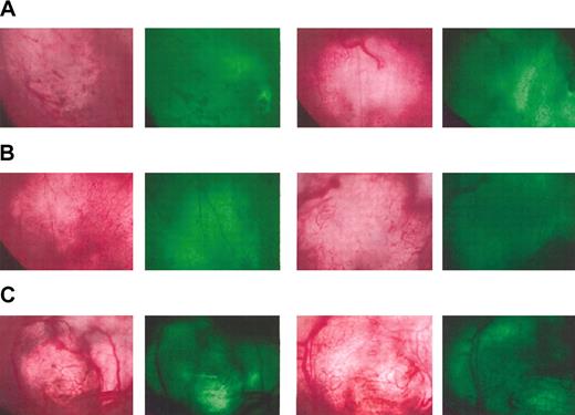 Figure 2. Inhibition of angiogenesis in mice immunized against angiogenesis-associated products. Mice were immunized 3 times with DCs transfected with VEGF (A) or VEGFR-2 (B) mRNA or injected with PBS (C). The angiogenic potential was determined using the dorsal skin-fold window-chamber assay. At 4 weeks following immunization, mice were implanted with window chambers and 5 days later inoculated with GFP-expressing B16 melanoma cells. Tumor growth and neovascularization were followed by light and fluorescent microscopy starting 4 days after tumor implantation. Representative pictures taken by light microscopy (left) and fluorescent microscopy to localize the implanted GFP-expressing tumor (right) from 2 mice per group are shown 14 days after tumor implantation.