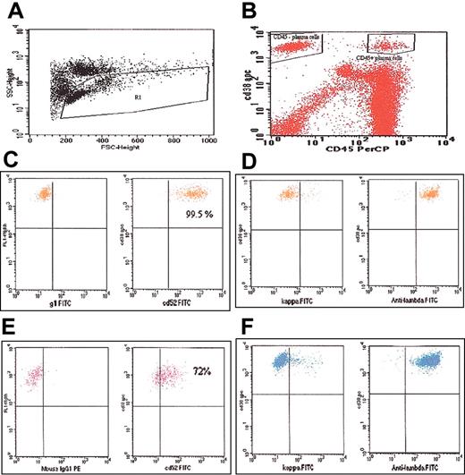 Figure 1. Flow cytometry plots. (A) Plot showing gating of the lymphocyte-monocyte population. (B) Plot showing the CD45+ and CD45- fractions of the CD38+ PCs gated separately. (C) Plot showing CD52 expression on the CD45+/CD38+ cells. (D) Plot demonstrating monoclonality of the CD45+ cells; kappa or lambda staining is on the x-axis. (E) Plot showing CD52 expression on the CD45-/CD38+ cells. (F) Plot demonstrating monoclonality of the CD45- cells; kappa or lambda staining is on the x-axis.