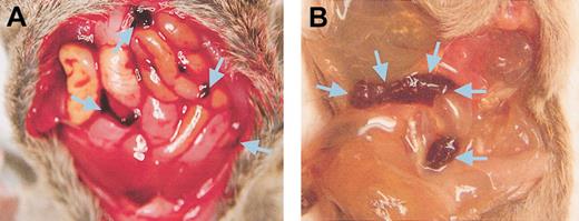 Figure 5. Examples of spontaneous hemorrhage in mice expressing u-PA in their platelets. (A) Mouse with peritoneal lining opened showing free blood in the peritoneal space indicated by arrows. (B) Mouse with a loop of small bowel filled with free blood indicated by arrows.