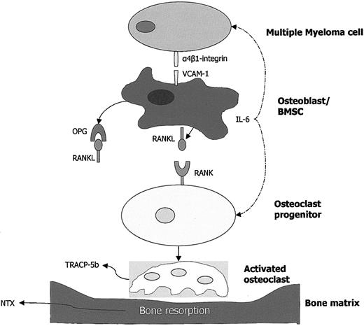 Figure 5. Role of the MM microenvironment in osteoclast activation. Adherence of MM cells to bone marrow stromal cells (BMSCs) enhances the production of RANKL and IL-6, whereas it suppresses the production of OPG (the decoy receptor of RANKL). RANK/RANKL interaction results in osteoclast differentiation, proliferation, and activation, leading to increased bone resorption (increased levels of TRACP-5b and NTX).