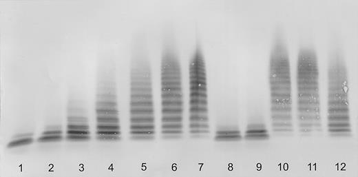 Figure 1. Quantitative immunoblotting of purified VWF substrate degraded by ADAMTS-13 in plasma dilutions. Lanes 1-7 = assay calibration by normal plasma dilutions of 1:20 (100% activity), 1:40 (50%), 1:80 (25%), 1:160 (12.5%), 1:320 (6.25%), 1:640 (3%), and buffer (0%). Lanes 8-12 = plasma dilutions (1:20) of the proposita and her parents. Lane 8 = father (∼50% activity), lane 9 = mother (∼50%), lanes 10-12 = proposita (lane 10 = March 13, 2003, before plasma infusion, < 3%; lane 11 = March 27, 2003, before plasma infusion, < 3%; lane 12 = March 27, 2003, 2 hours after plasma infusion, ∼8%).