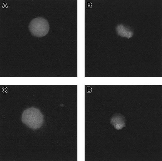 Figure 9. Effect of RBC supernatant on the FMLP-induced polarization and redistribution of CD11b. (A) Neutrophils exposed to FITC-conjugated anti-CD11b mAb. (B) Neutrophils exposed to 1 μM FMLP and labeled with FITC-conjugated anti-CD11b mAb. (C) Neutrophils preincubated with RBC supernatant (1:1 × 105, vol/vol dilution), exposed to 1 μM FMLP, and labeled with FITC-conjugated anti-CD11b mAb. (D) Neutrophils preincubated with TGF-β1–depleted RBC supernatant (1:1 × 105, vol/vol dilution), exposed to 1 μM FMLP, and labeled with FITC-conjugated anti-CD11b mAb.