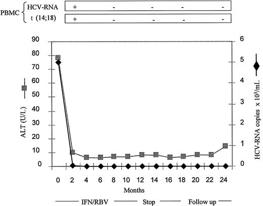 Figure 1. Results in one patient with SR. Analysis of serum ALT values, serum HCV RNA titer, BL HCV RNA, and t(14;18) translocation in a representative SR patient (no. 5) who maintained negativity of both BL HCV sequences and t(14;18) during follow-up.