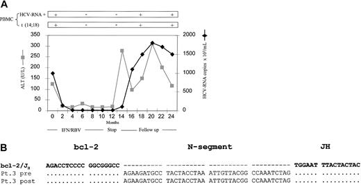 Figure 2. Results after viral and clinical relapse. (A) ALT values, serum HCV RNA titers, BL HCV RNA detection, and t(14;18) translocation in a representative patient (no. 3) who had a relapse during follow-up after a transient CR. (B) DNA sequence of bcl-2/JH junctions detected in total DNA extracted from peripheral BLs of the same patient, taken at time 0 (pretreatment) and at 9 months of follow-up (posttreatment); bcl-2, N-segment, JH: sequences of the bcl-2/JH junction corresponding to bcl-2 gene (chromosome 18), N-segment, and JH region of the IgH locus (chromosome 14), respectively. Line bcl-2/JH: alignment was done on bcl-2 (GenBank accession no. M14745) and IgH locus J-regions (accession no. M25625; line bcl-2/JH). Pt indicates patient number (Tables 1 and 2); pre and post, sequences corresponding to peripheral blood samples taken before and after IFNα treatment, respectively. Dots indicate identical nucleotides; gaps in sequences (–) were introduced for clarity.