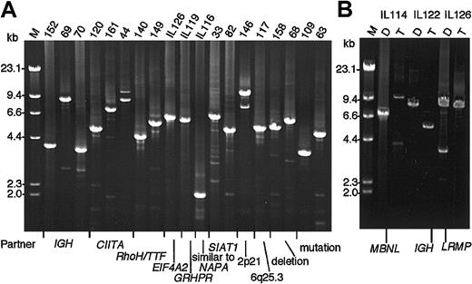 Figure 3. Representative ethidium bromide–stained gel electrophoresis of LDI-PCR of the BCL6. (A) The sizes of the LDI-PCR products are unique to each case. (B) A gain or a loss of partner/BCL6 fusion was observed in the paired diagnosis-transformation samples. The LDI-PCR products represent fusions either on the der(3) or der(partner), and partner genes or loci identified by sequencing analysis of the products are indicated at the bottom. An aliquot of 2 to 10 μL was loaded in each lane and electrophoresed through a 0.7% agarose gel. HindIII-digested DNA was used as a molecular weight marker. D indicates at the diagnosis; T, at the transformation.