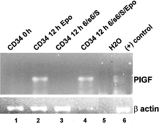 Figure 2. Erythropoietin induces PlGF expression in bone marrow progenitor cells. CD34+ progenitor cells from a normal bone marrow were analyzed for PlGF mRNA by RT-PCR analyses soon after isolation (lane 1) or after a 12-hour exposure either to 3 U/mL erythropoietin (lane 2) or to erythropoietin-independent erythroid differentiation medium (IL-6, sIL-6 receptor, and SCF; lane 3) or erythropoietin-independent erythroid differentiation medium with additional erythropoietin (3 U/mL; lane 4). The bottom panel shows an RT-PCR for β-actin for the corresponding samples. Lanes 5 and 6 consist of negative (H2O) and positive controls (human pulmonary microvascular endothelial cells), respectively.