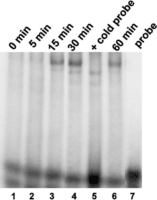 Figure 3. Erythropoietin increases nuclear DNA binding activity of MTF-1 transcription factor. Electrophoretic mobility shift assay (EMSA) on nuclear extracts from the SK-N-MC Ewing sarcoma cell line, which expresses both PlGF and a functional erythropoietin receptor, using a radiolabeled oligonucleotide probe containing MTF-1 response elements. The blot shows increased nuclear DNA binding of MTF-1 to the probe within 15 minutes (lane 3), with a maximal binding at 30 minutes (lane 4). The response is abrogated with excess cold (nonradiolabeled) oligonucleotide MTF-1 probe (lane 5).