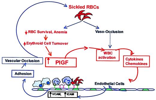 Figure 8. A working model showing the link between increased erythropoiesis in SCD and inflammation. In SCD, increased sickling of RBCs leads to vaso-occlusion, which has been suggested to activate leukocytes. Alternatively, we propose that increased PlGF, resulting from erythroid hyperplasia and increased erythropoietin levels in SCD, activates leukocytes, specifically monocytes, and results in elevated proinflammatory cytokines and chemokines. These cytokines have been previously shown to up-regulate expression of VCAM and ICAM-1 in cultured endothelial cells and thereby increase the adherence of sickle RBCs and leukocytes through their counterreceptors. The increased adherence of these cells to endothelium has also been shown to cause vaso-occlusion in in vivo models. In this proposed schema of events in SCD, previously published associations are shown in blue, speculations are indicated with a dashed blue line, and our data and its interpretations are depicted in red. We conclude that erythroid cells intrinsically release a factor, PlGF, which directly activates leukocytes, specifically monocytes, to modulate the inflammatory tone and clinical severity of SCD.