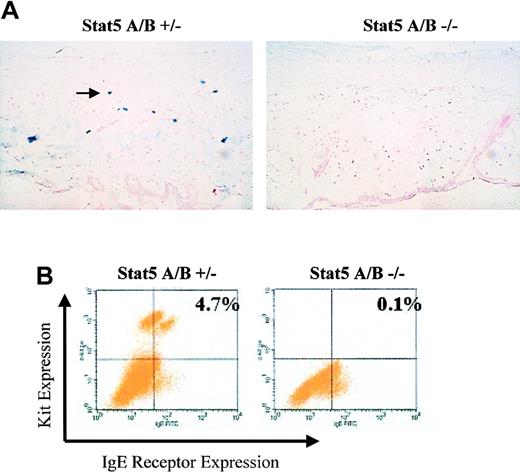 Figure 7. Stat5-deficient mice lack detectable mast cells. (A) An example of alcian blue staining from ear skin of Stat5A/B+/– and Stat5A/B–/– littermate animals. Original magnification, × 200. (B) Flow cytometry profile of Kit and FcϵRI expression on peritoneal cells extracted from Stat5A/B+/– or Stat5A/B–/– littermate animals at 12 weeks of age. Background staining with control antibodies was approximately 0.05%.