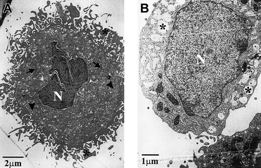 Figure 5. Ultrastructural analysis of MK-801–treated megakaryocytes. Ultrastructural characteristics of CD34+-derived megakaryocytes cultured for 14 days with 25 ng/mL TPO only (A), or TPO and 50 μM MK-801 (B). (A) TPO-only treated cells contained the expected characteristics of mature megakaryocytes: an indented multilobed nucleus (N), α-granule formation (arrows), dilated demarcation membrane system (arrowheads), and proplatelet formation (*). (B) However, cells treated with TPO and MK-801 had a rounded nucleus (N), lacked α-granules, demarcated membrane, and proplatelets, and also exhibited large cyoplasmic cisternae (*). Note different scales.