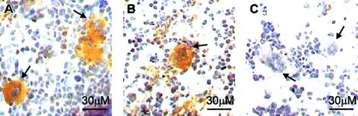 Figure 6. Effects of c-mpl ablation on megakaryocytic NR1 expression. Immunohistochemical identification of NR1 expression by bone marrow megakaryocytes (arrows) from wild-type control mice (c-mpl+/+; panel A) and c-mpl knock-out mice (c-mpl–/–; panel B). (C) Antibodynegative control. DAB-peroxidase disclosure with hematoxylin counterstain. Arrows refer to the position of megakaryocytes.
