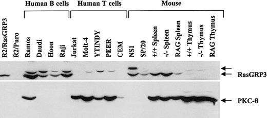 Figure 1. Expression of RasGRP3 in the B-cell lineage and coexpression with PKC-θ in Ramos B cells. Cellular proteins in postnuclear supernatants (100 μg per sample) were immunoblotted with the anti-RasGRP3 antibody (top panel). The uppermost arrow indicates a nonspecific band. Lysates were also probed with an anti–PKC-θ antibody (bottom panel).