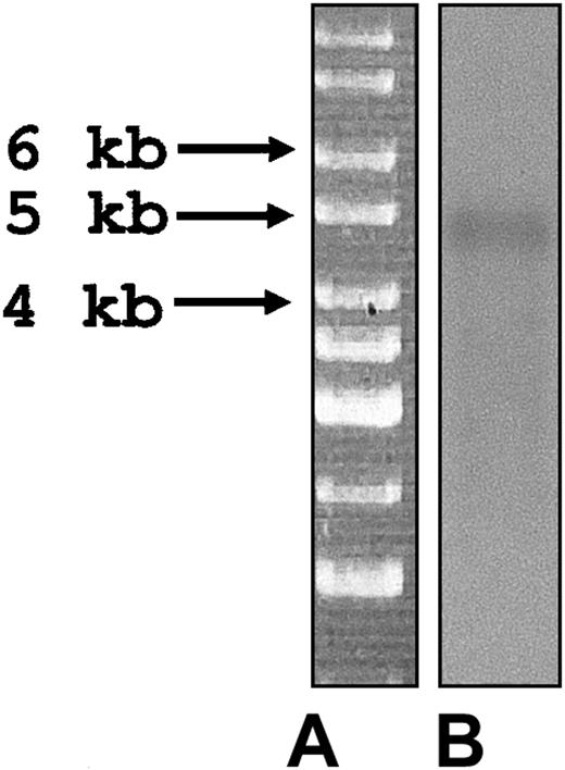 Figure 2. cDNA blot analysis of P textilis cDNA library. (A) Marker. (B) cDNA blot probed with a pseutarin C nonenzymatic subunit gene-specific probe (see “cDNA blot analysis” in “Materials and methods” for details).