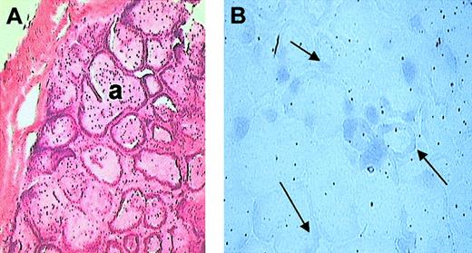 Figure 3. In situ hybridization. (A) Hematoxylin and eosin staining. P textilis venom gland showing acini (a) lined with single layer of epithelium. (B) NBT/BCIP (nitro-blue tetrazolium/5-bromo-4-chloro-3-indolyl phosphate p-toluidine salt) staining. Localization of nonenzymatic subunit of pseutarin C mRNA in P textilis venom gland by in situ hybridization using DIG-labeled purified PCR product as probe. Arrows indicate gene-specific staining. The mRNA of pseutarin C is localized to the columnar epithelial cells. Original magnification, × 10.
