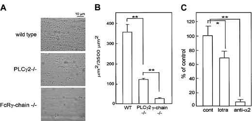 Figure 7. PLCγ2-deficient platelets showed limited integrin-dependent platelet adhesion on collagen at a medium rate of shear. Mouse blood anticoagulated with PPACK and heparin was perfused through a collagen-coated microcapillary at a shear rate of 800 s–1 for 2 minutes and nonadherent cells were washed for 8 minutes at the same shear rate with modified Tyrode buffer containing 2 mM CaCl2 and 1 U/mL heparin. After washing, microscope images were recorded from at least 6 different microscope fields. (A) Representative images of platelet adhesion from wild-type, PLCγ2–/–, and FcRγ-chain–/– mice. (B) Image analysis was performed off-line using ImagePro plus software. Platelet adhesion results are expressed as mean ± SEM surface area covered by platelets. (C) Blood from PLCγ2–/– mice was incubated without (control) or with 10 μM lotrafiban (lotra), 20 μg/mL anti-α2 antibody (HMα2; anti-α2) for 5 minutes before perfusion. Platelet adhesion is expressed as a percentage of control. *P < .05; **P < .01. The data were representative of 2 experiments.