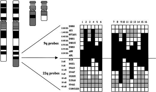 Figure 3. Derivative chromosme 9 deletions are large, span the translocation breakpoint, and demonstrate heterogeneous deletion breakpoints. A summary of FISH mapping of 16 patients with deletions is shown. Locus-specific probes from 9q34 and 22q12 together with corresponding physical and genomic map data are shown. White boxes indicate the retention of a locus; black boxes indicate the loss of a locus; and gray boxes indicate not performed. (Adapted from Sinclair et al.39)