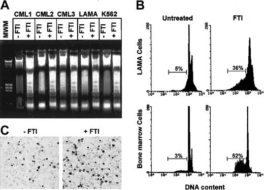 Figure 2. FTI-induced inhibition of cell viability is in part related to induction of apoptosis. (A) Agarose gel stained with ethidium bromide after electrophoresis of low-molecular-weight DNA extracted from a constant number of total marrow cells of 3 representative CML patients and from LAMA and K562 cells exposed for 48 hours to FTIs at the IC50 (CML1 to α-HFPA; CML2 to Man-A; CML3, LAMA, and K562 to SCH). (B) A representative flow cytometric detection of apoptic hypodiploid DNA peak-stained with propidium iodide derived from LAMA cells and total marrow cells of a CML patient exposed to SCH (1 μM). At least 6 × 105 events were counted per sample. Horizontal bars indicate hypodiploid DNA peak and its percentage. (C) In situ TdT assay to quantitate the number of apoptotic marrow cells from a CML patient after culture for 48 hours in absence and presence of SCH (1 μM). Darkly stained cells are apoptotic. Original magnification, × 40.