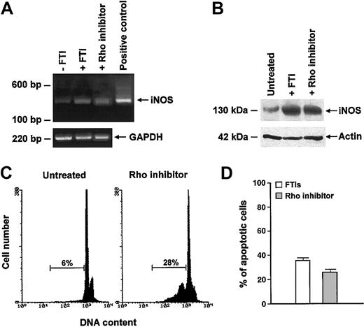 Figure 7. Inhibition of Rho induces iNOS expression and apoptosis in CML cells. (A-B) Rho inhibitor C3 exoenzyme significantly increased iNOS mRNA (A) and protein (B) in total marrow cells from a CML patient. SCH (1 μM) was used to compare the iNOS-enhanced expression by Rho inhibitor and FTIs. (C-D) Inhibition of Rho-induced apoptosis of CML cells. (C) Flow cytometric detection of apoptotic hypodiploid DNA derived from a CML patient. Horizontal bars indicate hypodiploid DNA peak and its percentage. (D) Bars represent percentage of apoptotic cells, enumerated by the TdT assay, after exposure to FTIs (□) and to Rho inhibitor (▦) (cumulative mean percentage ± SEM: 36.2% ± 3% vs 27% ± 2%, respectively; P = .03).