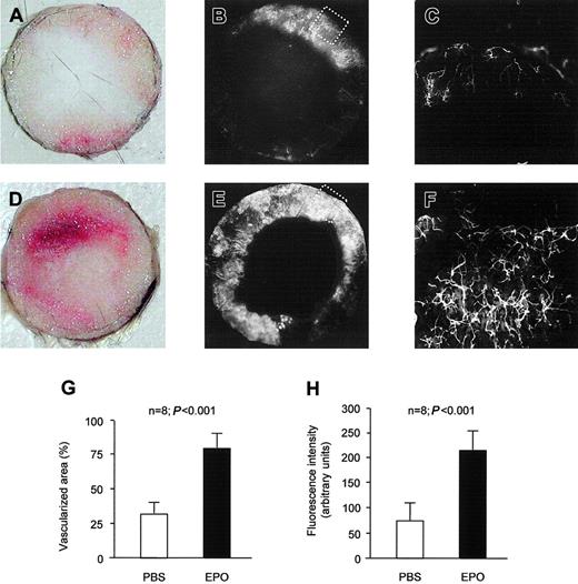 Figure 3. Epo stimulates inflammatory neovascularization in vivo. In the control group, subcutaneous implantation of a polyvinyl sponge for 2 weeks resulted in ingrowth of new vessels. (A) Representative picture of the native disc. (B) Functional neovascularization of the disc was visualized by perfusion with space-filling fluorescent microspheres prior to explantation of the disc. (C) Vessel caliber and density of the network shown by microscopic picture with a × 10 objective (detailed view of tagged area in panel B). Epo increased the vascularized area of the disc (D-E) and the vessel density in the disc (F). Panel F presents a detailed view of tagged area in panel E. Quantification of the vascularized area of the disc (G) as well as the fluorescence intensity of the vascularized area (H) revealed significant differences between PBS- and Epo-treated animals. Data are given as means ± SD.
