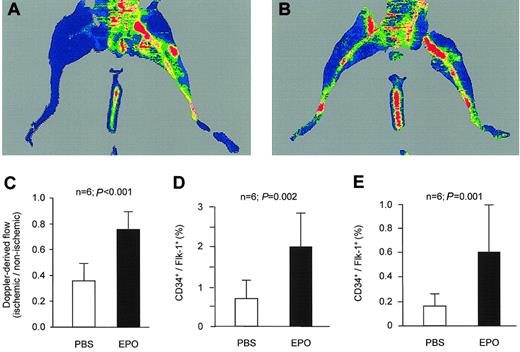 Figure 4. Epo stimulates ischemia-induced neovascularization in vivo. PBS or Epo was administered by daily subcutaneous injections during the first 3 days of each week. After 2 weeks, perfusion of the ischemic limb was still impaired in PBS-treated mice (A). In contrast, Epo-treated mice showed a marked increase in hind-limb perfusion (B). Quantification of the perfusion of the ischemic hind limb relative to the contralateral, nonischemic hind limb indicated that treatment with Epo caused a significant increase in hind-limb perfusion (C). FACS analysis 7 days after induction of ischemia revealed that Epo treatment further enhanced the ischemia-induced increase in CD34+/flk-1+ cells in spleen (D) and peripheral blood (E). Data are given as means ± SD.