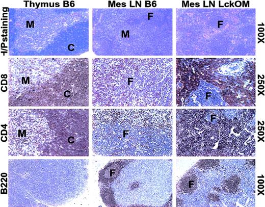Figure 1. T- and B-cell zones in the LckOM LN. Sections from B6 thymus and LN and from LckOM LN were stained with hematoxylin-phloxin or labeled with antibodies specific for CD4, CD8, and B220. C indicates thymic cortex; F, B-cell follicle; and M, thymic medulla. The text to the right of the panels indicates the magnification for each row.