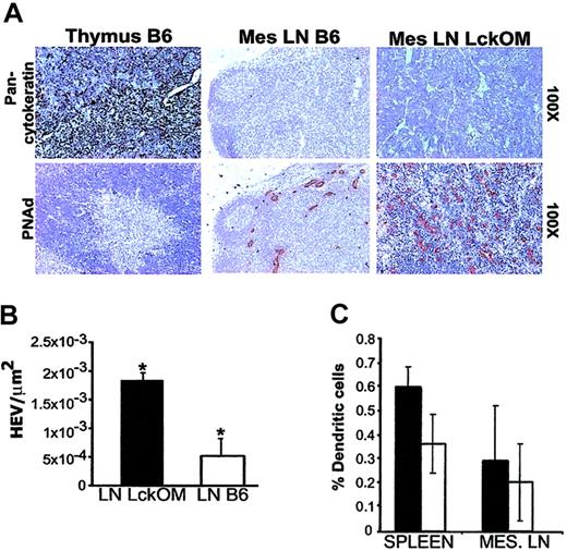 Figure 2. Structure and composition of the LckOM LN stroma. (A) Sections from B6 thymus and LN and from LckOM LN were stained with hematoxylin and labeled with antibodies specific for cytokeratin and CD62L ligand (PNAd carbohydrate epitope). The text to the right of the panels indicates the magnification for each row. (B) The number of CD62L ligand+ blood vessels per square micrometer was significantly increased in the LckOM relative to the LN (*P < .0001, Student t test). (C) Flow cytometry analyses revealed no significant difference in the proportion of DCs (MHC class II+CD11c+) between B6 (□) and LckOM (▪) secondary lymphoid organs.