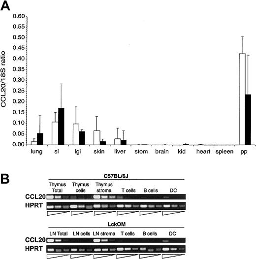 Figure 5. Expression of CCL20 transcripts in lymphoid and nonlymphoid organs. (A) CCL20 mRNA expression was estimated in various organs of B6 (□) and LckOM (▪) mice by semiquantitative RT-PCR. Results are shown as the ratio of CCL20 expression over internal control (18S) and represent the mean ± SDof3to9 mice per organ. si indicates small intestine; lgi, large intestine; stom, stomach; kid, kidney; and pp, Peyer patches. No significant difference was found between B6 versus LckOM organs (Mann-Whitney U test and Student t test). (B) CCL20 is produced by nonlymphoid stromal cells in the B6 thymus and LckOM LN. RNA was extracted from the B6 thymus and LckOM LN as follows: total organ, a cell suspension (cells) obtained after mechanical disruption of the thymus or LN through a cell strainer, and the remaining nonsuspendable fraction (stroma). Cell suspensions from collagenase-treated organs were sorted into T cells (Thy1.2+), B cells (CD19+), and DCs (CD11c+MHC II+). Serial 1:5 dilutions of each cDNA were used as template in semiquantitative RT-PCR. Representative results of 3 experiments are shown.