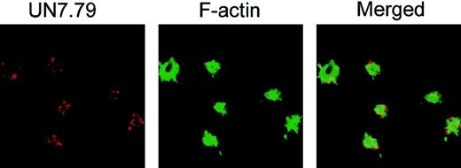 Figure 3. Successful incorporation of antibody into platelets by DMSO treatment. Confocal images of washed platelets loaded with UN7.79 using DMSO as described in “Materials and methods.” Platelets were allowed to spread for 45 minutes, then fixed and stained with secondary antibody to detect UN7.79 (red) or phalloidin to detect F-actin (green). Although filopodia are visible, CIB cannot be detected at the tip of the filopodia owing to antibody inhibition of CIB relocation. Original magnification, × 600.