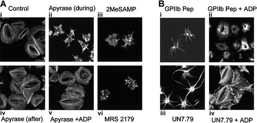 Figure 7. Relationship of the CIB-GPIIb/IIIa complex to platelet granular secretion of ADP. Formation of the CIB-GPIIb/IIIa complex may be necessary for platelet granular secretion of ADP. (A) Confocal images of washed platelets allowed to spread on Fg and stained for F-actin. Ai: Untreated platelets are fully spread. Aii: Apyrase is present during platelet adhesion. Aiv: Apyrase was added to spread platelets. Av: Platelets were allowed to spread in the presence of apyrase. After 45 minutes, platelets were washed free of apyrase and exogenous ADP was added. ADP receptor P2Y12 antagonist, 2MeSAMP (Aiii) or P2Y1 antagonist MRS 2179 (Avi), is present during platelet adhesion to Fg. (B) Confocal images of washed platelets allowed to spread on Fg and stained for F-actin. Bi: Platelets loaded with GPIIb cytoplasmic peptide (GPIIb Pep) showed filopodia. Bii: Exogenous ADP was added to GPIIb Pep-loaded platelets. Biii: Platelets loaded with UN7.79 showed long filopodia. Biv: Exogenous ADP was added to UN7.79-loaded platelets. Original magnification, × 600.